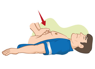 First Aid resuscitation (CPR), abdominal compression massage