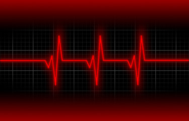 Electrocardiogram - Concept of healthcare