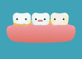 Healthy tooth