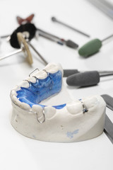 Narzędzia ortodontyczne, aparat ortodontyczny - obrazy, fototapety, plakaty