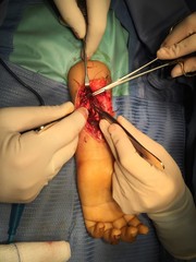 Chirurgia della mano