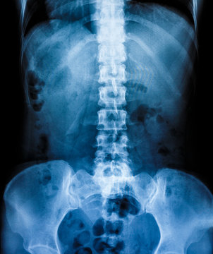 X-Ray scan human