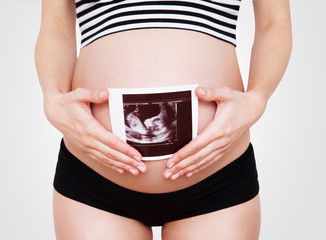 Pregnant woman holding ultrasound image