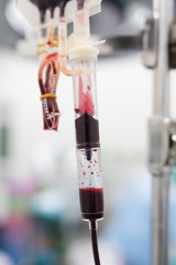 giving packed red cell blood during surgery