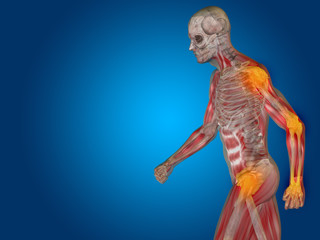 Conceptual human body anatomy pain on blue