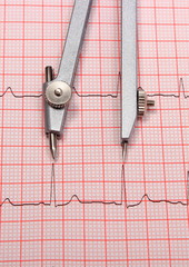 Electrocardiogram graph report and calipers