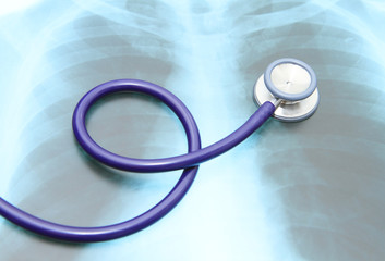 Close up image of stethoscope on x-ray film