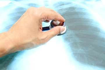 Hand holding a stethoscope on x-ray film