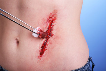Injured abdomen with blood on blue background