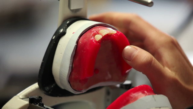 Develop dental prosthesis