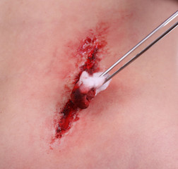 Fototapeta premium Injured abdomen with blood isolated on white