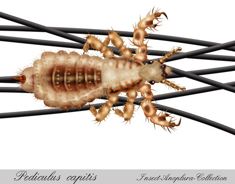 babylouse,nit, hair