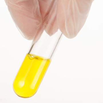 Yellow Liquid in Test Tube