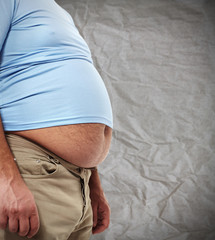 Obesity.