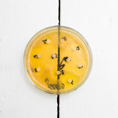 Petri dish with growing bacteria