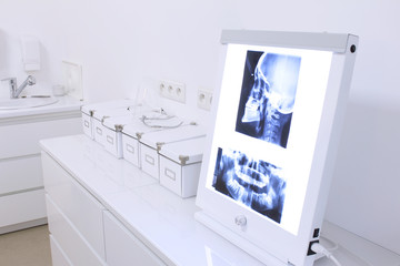 Stomatologia_rentgen - obrazy, fototapety, plakaty