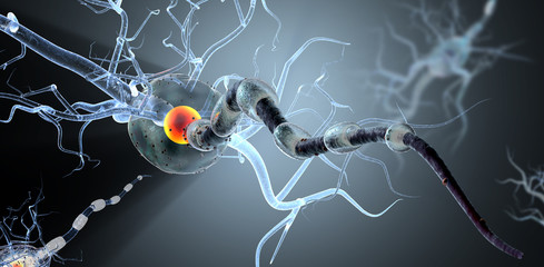 nerve cells concept for tumors,brain surgery