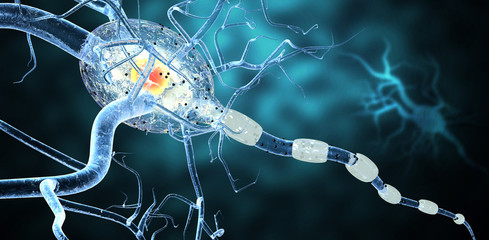 nerve cells, Neurologic Disease, tumors,brain surgery - 77977292