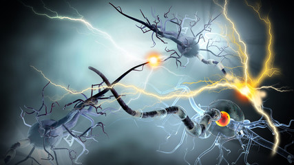 nerve cells, Neurologic Disease, tumors,brain surgery - 77977417