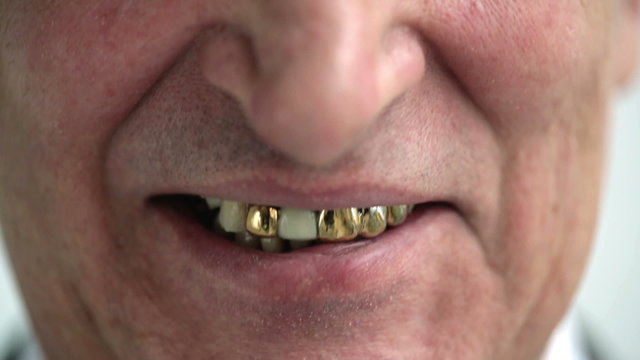 Smiling old man with gold teeth