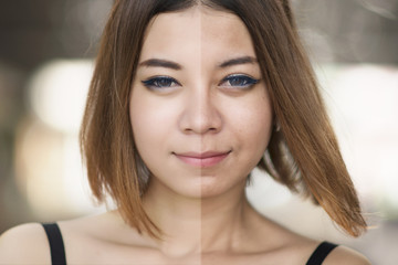 Woman with spotty skin with deep pores and blackhead and healed