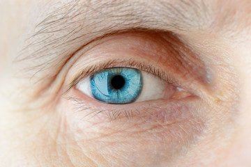 Macro of a hard contact lens on woman's blue eye - obrazy, fototapety, plakaty