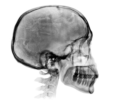 Detailed Human skull X-ray image
