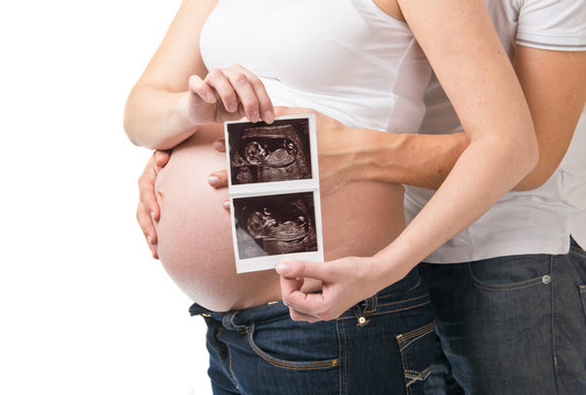 Pregnant young woman and man showing ultrasound picture of baby
