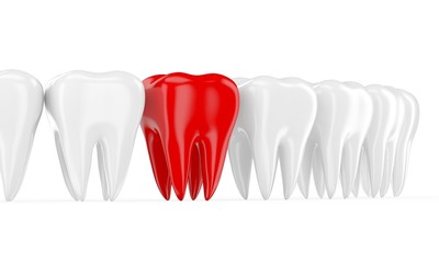 Aching tooth in row of healthy teeth. 3d