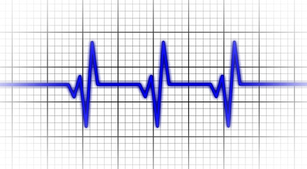 Electrocardiogram - Concept of healthcare