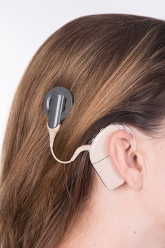 Young woman with cochlear implant