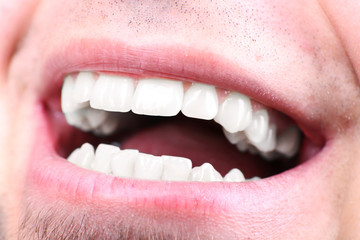 Smiling man after visit dentist om blurred background, macro