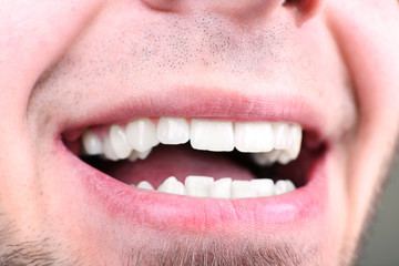Smiling man after visit dentist om blurred background, macro