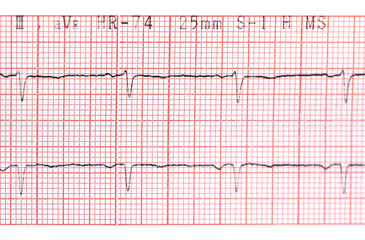 Electrocardiograph