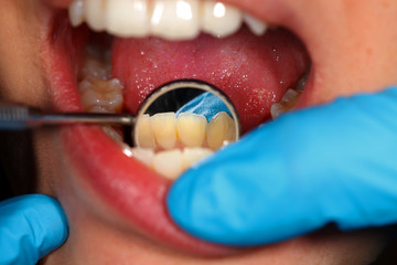 Dental examination