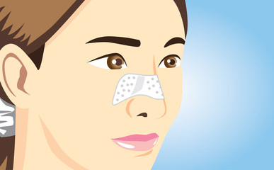 Closeup shot of acne pads on women nose