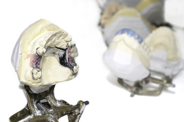 ceramic crowns in dental laboratory