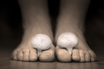 Mushrooms between the toes feet imitating toes fungus - obrazy, fototapety, plakaty