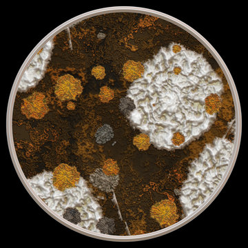 Petri dish with bacteria