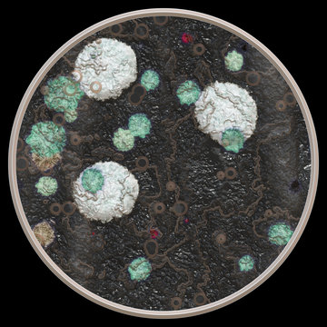 Petri dish with bacteria