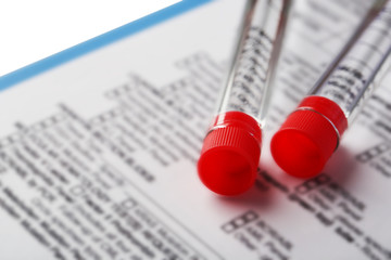 Test tubes and clipboard with medical history form close up