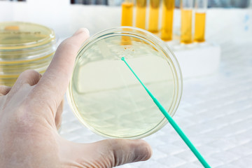 scientist with a hand holding a petri dish and the other an loop
