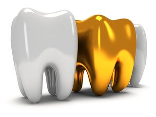 Gold and healthy teeth
