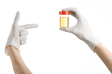 hand doctor in white gloves holding container of urine analysis