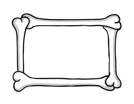 Bone frame