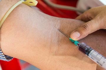 The blood sample is taken