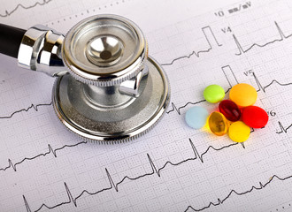 Electrocardiogram