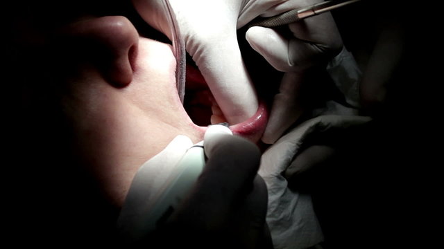 Dentist operating inside patient mouth cleaning and checking