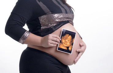 embarazada con ecografía 3d