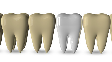 New tooth and old ones